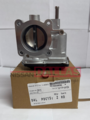 161194AF0A - Fuel System: Throttle Body for Nissan: Sentra Image