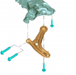 BE8Z3079C - Suspension: Lower Control Arm for Ford: Fiesta Image